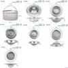 Stainless Steel Kitchen Sink Strainer Food Catcher for Most Sink Drains