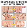 2025 Latest Model Nail Fungus Spray, Foot Moss Relief Deodorizing Odor Removal new