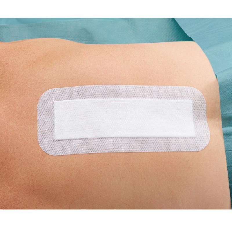 Cosmopor E Steril 10cm X 8cm Sterile Postoperative Dressing 25 Pcs