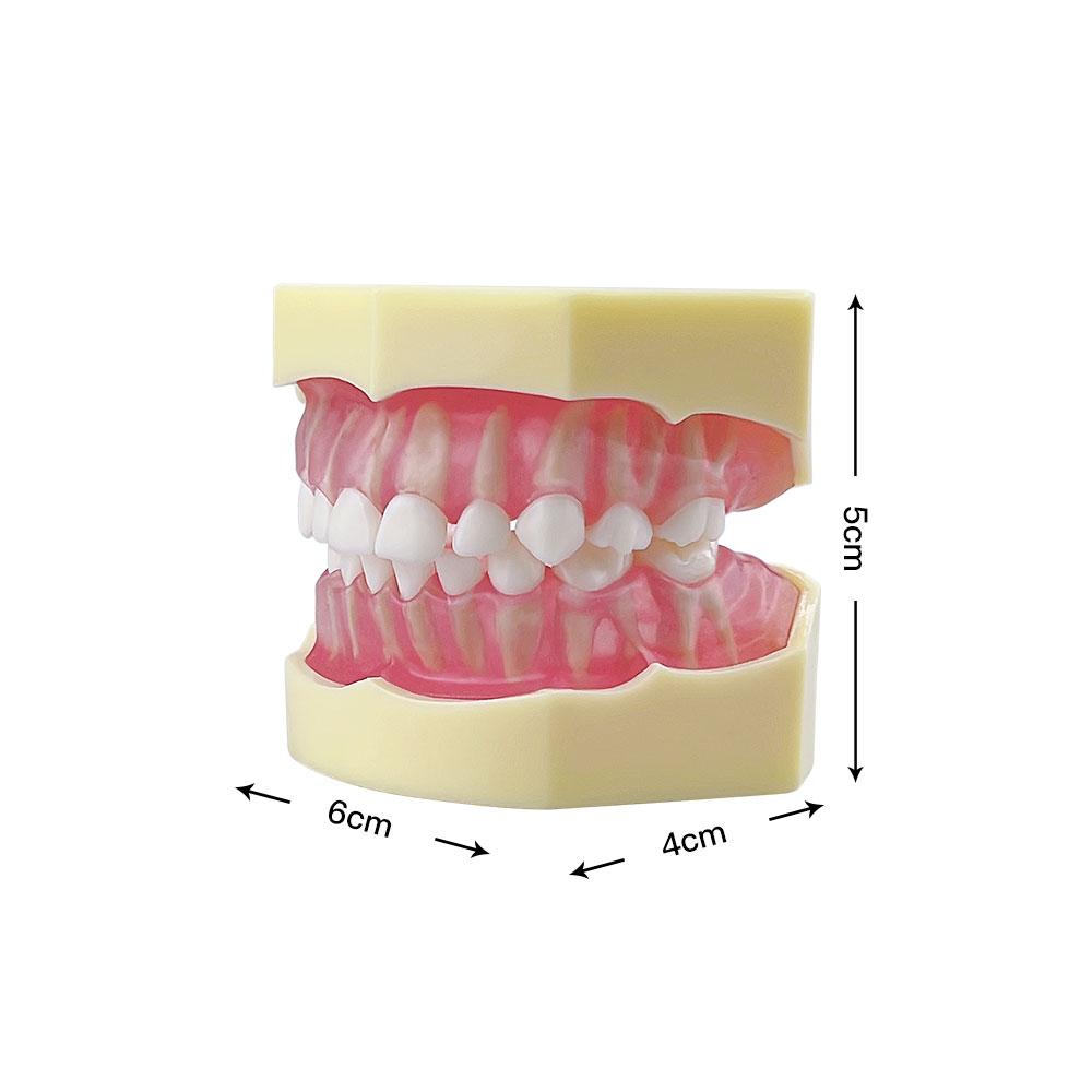Kids Teeth Model For Training Practice Tooth Extraction Model Dental Standard Model With Removable Teeth Gums Children TYPODONT