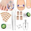 Kit de traitement de correction d'ongle incarné Set d'ongles incarnés en acier inoxydable Correcteur Lifter Pince à épiler Autocollant pour ongles Bandes à ressort Protections pour doigts Fo