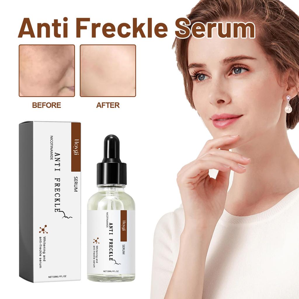 Hoygi Niacinamide Spot Brightening Serum Hydrating And Nourishing Skin Treatment For Dark Spots And Dull Complexion