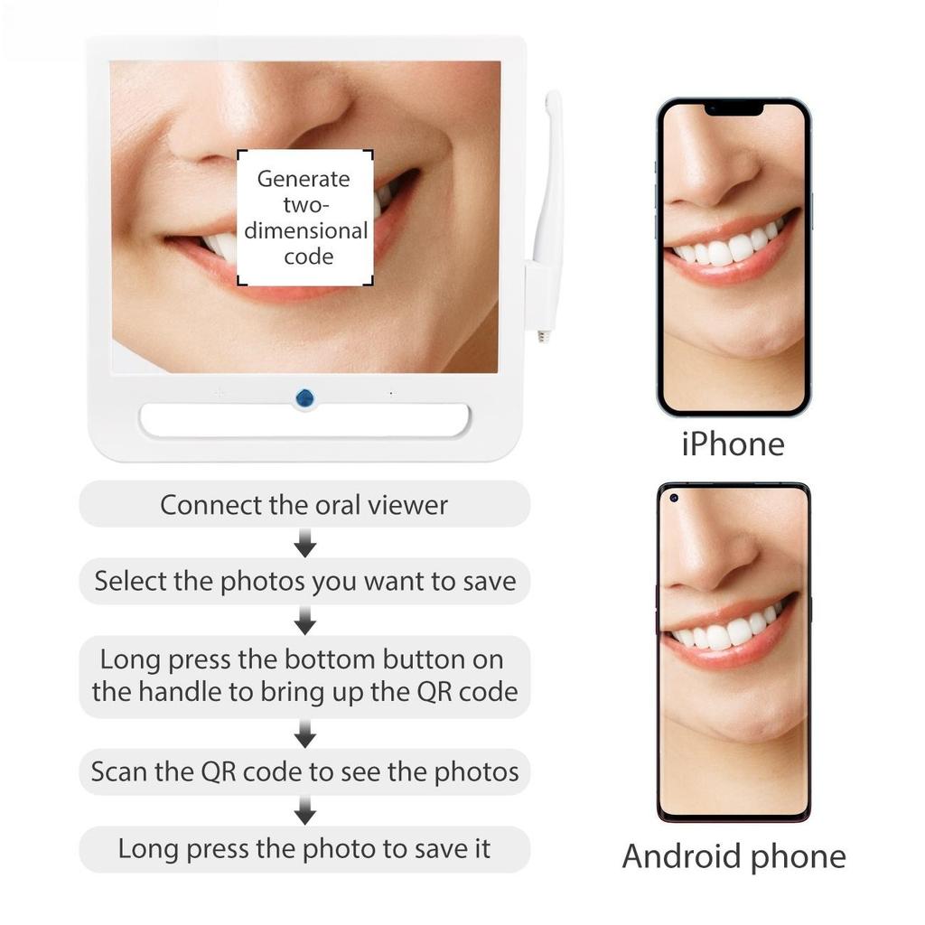 Zubní endoskop 17palcový LCD monitor VGA intraorální kamera 6LED Wifi digitální rádio stomatologie intraorální kamera 18 milionů pixelů