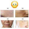 Retinolo Lumaca Aloe Crema viso Sbiancante antirughe Idratante Anti-età Viso Giorno Crema da notte Cura della pelle