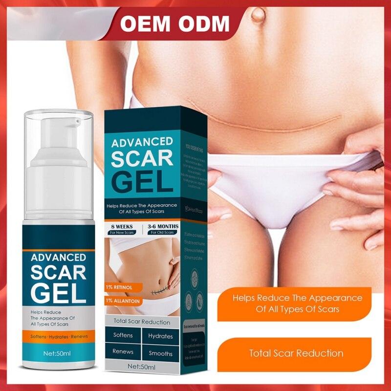 Scar Gel for Face Body Skin Care Scar Treatment for Both Old And Scars 50ml Make Scars Smaller & Less Visible Body Creams