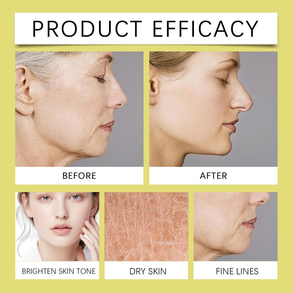 Collagen Moisturizing Cream Deeply Nourishes And Tightens The Skin, Improves Dryness And Roughness, Enhances Elasticity And Revives The Skin.