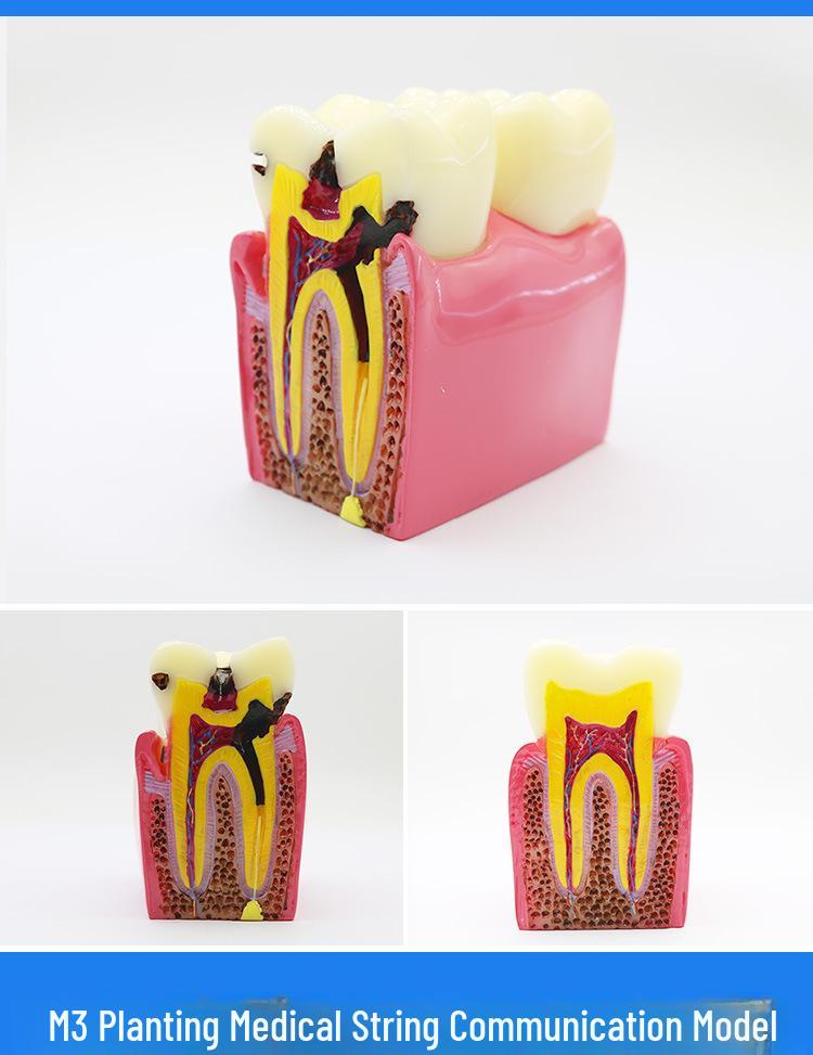 Dental Educational and Communication Model Set: Comprehensive, Removable, and Implant Restoration Models