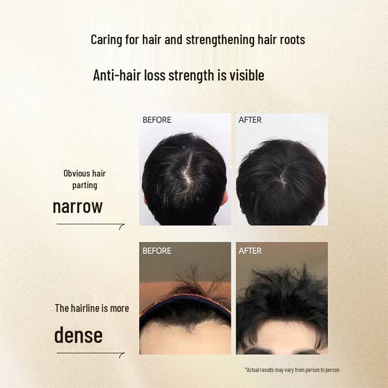 Yangyuanqing Men's Anti-Hair Loss & Oil Control Shampoo