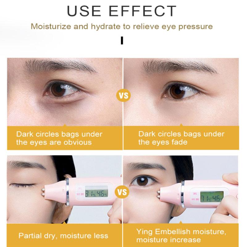 Caviar Eye Mask Moisturizing and Diminishing Fine Lines and Dark Circles Eye Patch Eye Care Essence