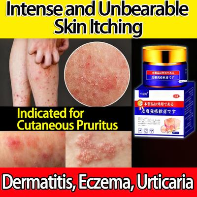 Eczema-Specific Anti-Itch Cream – Instant Relief with One Application, Long-Lasting Soothing
