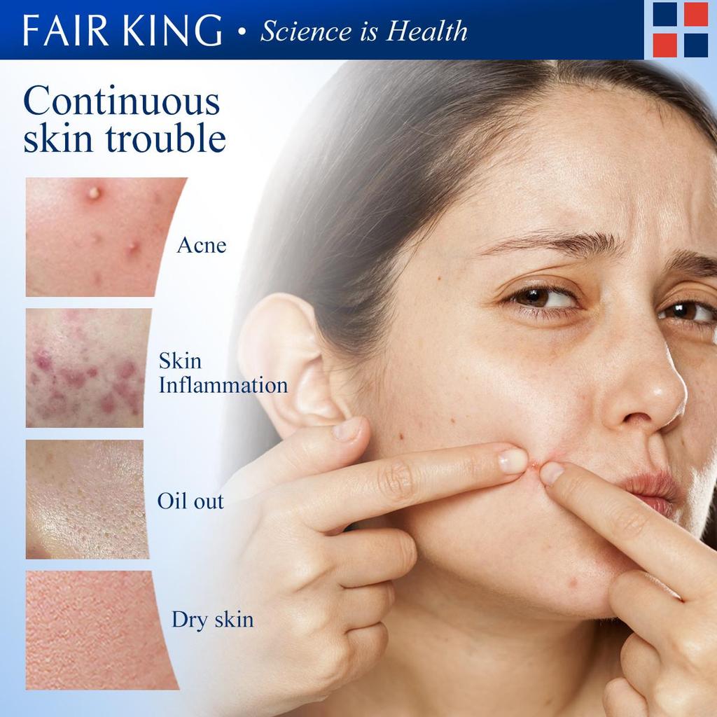 FAIRKING Tea Tree Acne Cream - Oil Control & Acne Treatment 15g