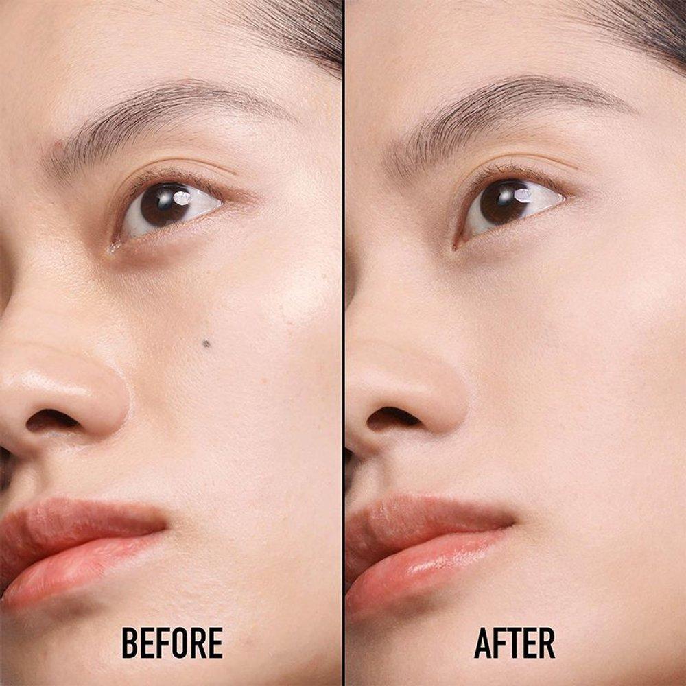 Forever Skin Correct