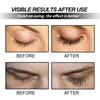 Eyelash Growth Serum—Strengthens Lashes, Nourishes Eyebrows and Eyelashes. Advanced Formula Promotes Fuller Lashes. 0.34 Fl Oz / 10 Ml.