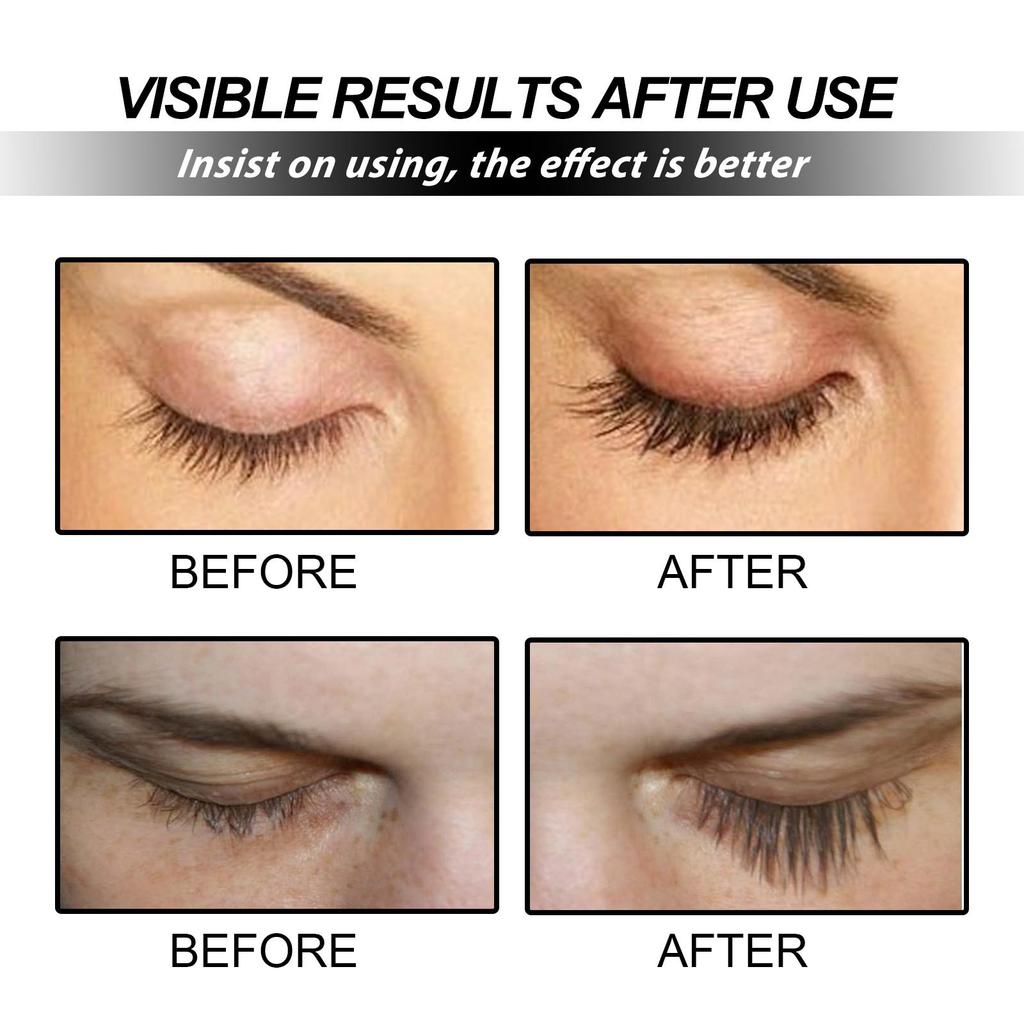 Eyelash Growth Serum—Strengthens Lashes, Nourishes Eyebrows and Eyelashes. Advanced Formula Promotes Fuller Lashes. 0.34 Fl Oz / 10 Ml.