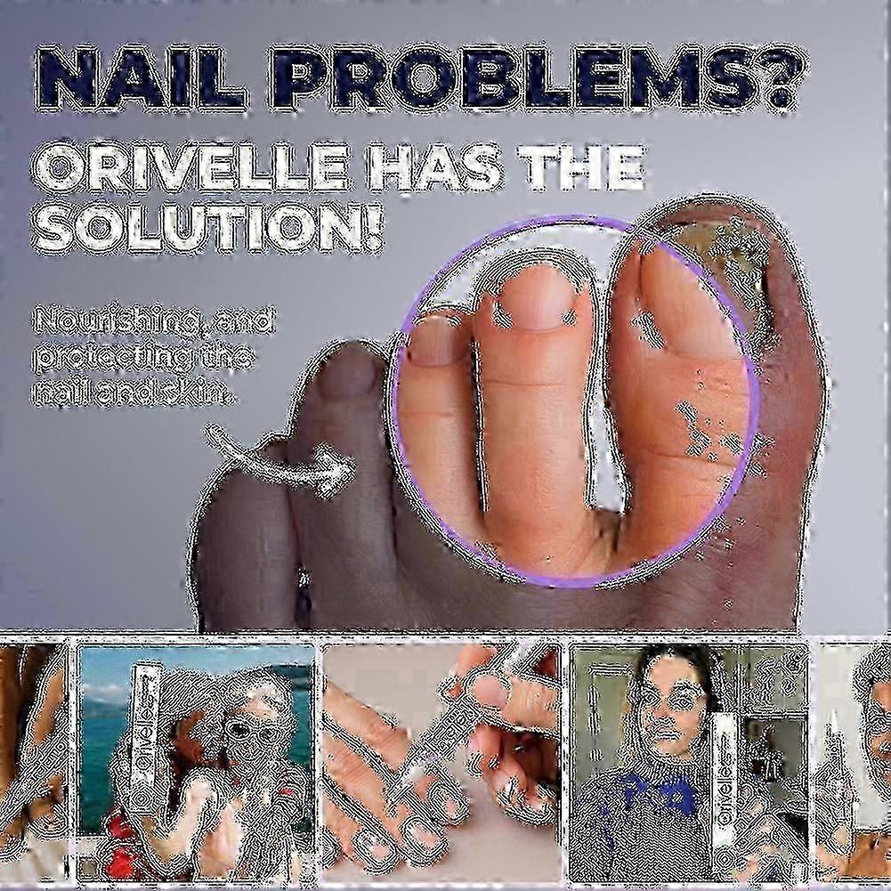 Penna Orivelle per Fungo dell'Unghia, Cura Extra Forte per Promuovere Unghie dei Piedi Sane e Forti-5-14 -xdl3