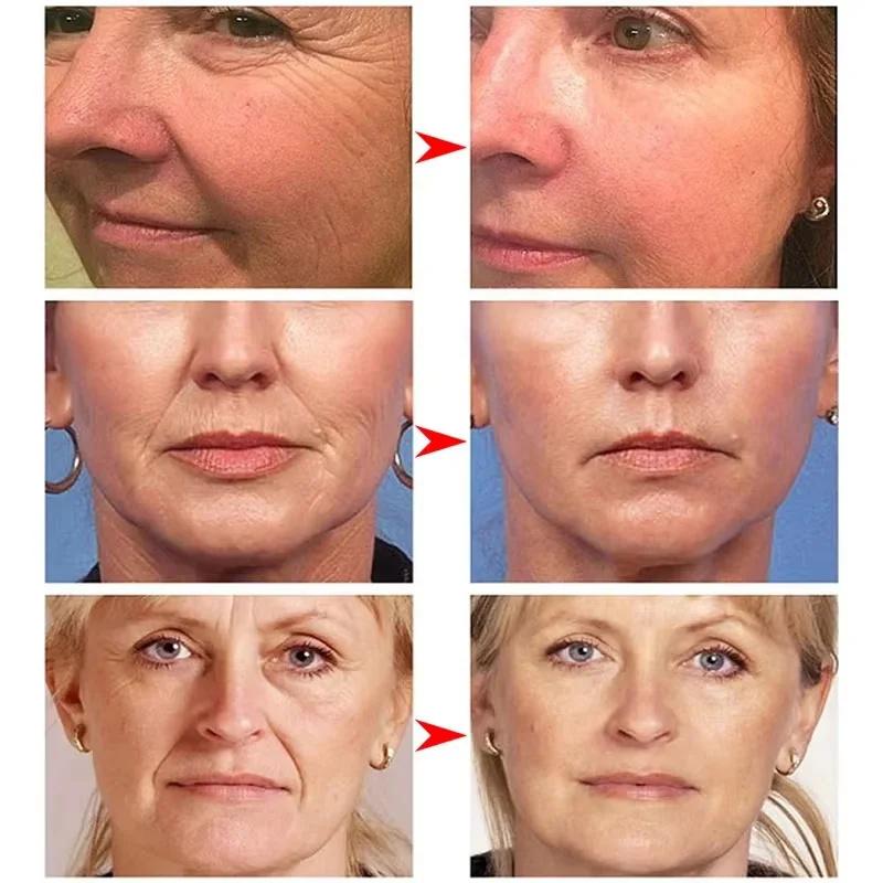 Retinol Wrinkle Remover Face Serum Instant Firming Lifting Anti-Aging Essence Fade Fine Lines Whitening Korean Skin Care Product