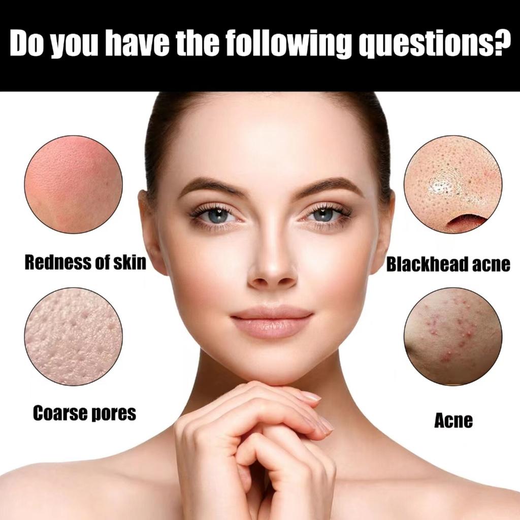 5ML/15ML/30ML/50ML/TRSTAY rezolvă problemele pielii și vă menține fața blocată în apă fără probleme, menținând-o umedă