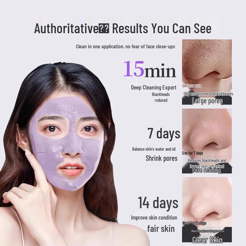 SEEDONVEUR Azelaic Acid Clay Mask for Blackhead & Pore Cleansing