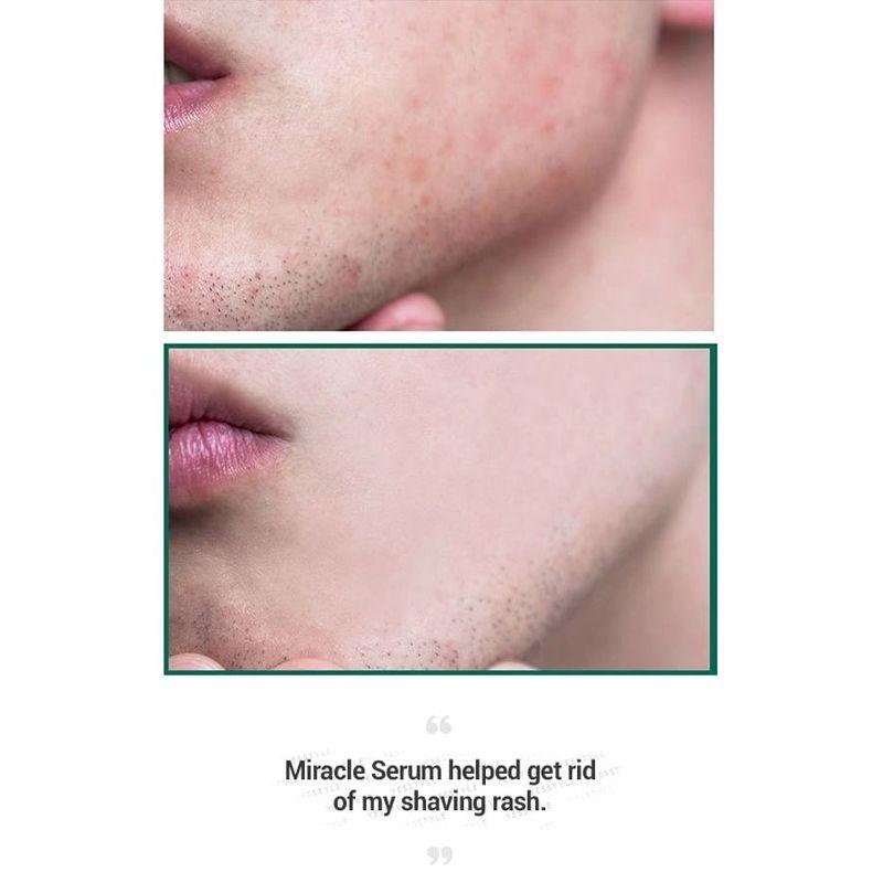 SOME BY MI AHA, BHA, PHA 30 Days Miracle Serum 50ml