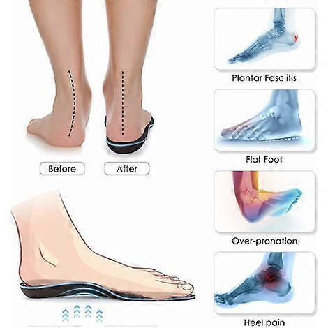 Arch Support Insoles for Plantar Fasciitis for Men and Women, Orthotic Insert for Flat Feet, Work Shoe Insole, Absorbs Shock with Every Step,