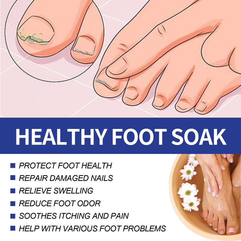 Ximonth Foot Care Pack With Nourishing Ingredients For Softened Skin And Callus Repair