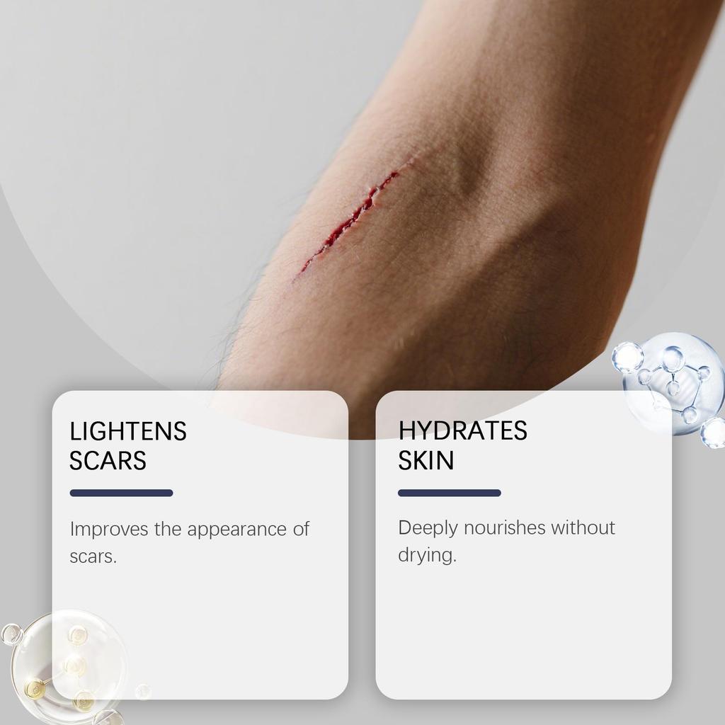 Skin Scar Moisturizing Care Stick: Smooths the Appearance of Skin Scars. Daily Care Cream