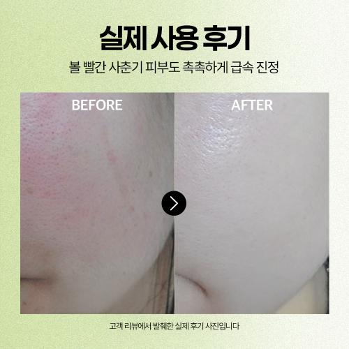 Epillow Artichoke Cica Cooling & Soothing Serum 50ml