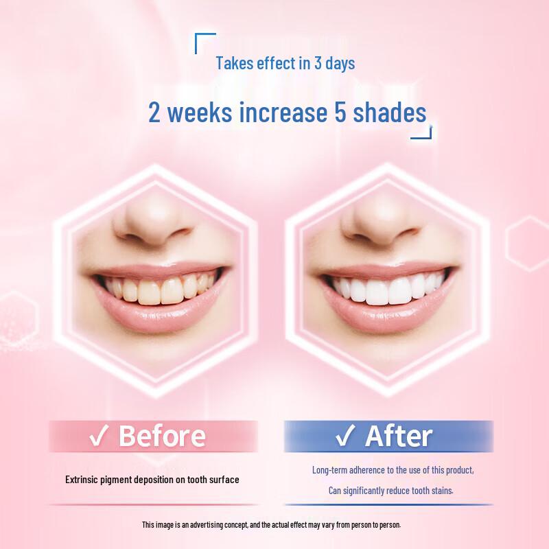 Leng Suan Ling Light-Sensitive Whitening Anti-Sensitivity Fresh Peach Toothpaste