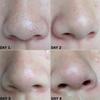 Nose Blackhead Remover Mask Deep Cleansing Skin Care Shrink Pore Acne Treatment Mask Nose Black Dots Pore Clean Strips