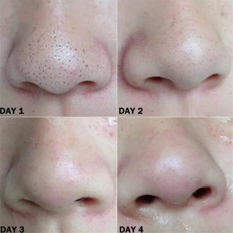 Nose Blackhead Remover Mask Deep Cleansing Skin Care Shrink Pore Acne Treatment Mask Nose Black Dots Pore Clean Strips
