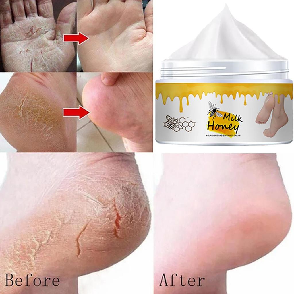 Sprukne hender og føtter reparerer krem, fukter, gir næring til huden og etterlater huden myk og delikat