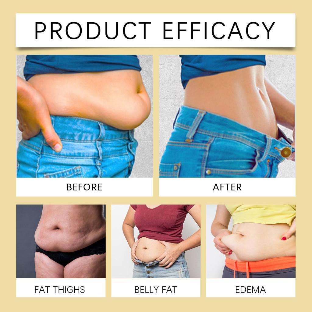 Ximonth Bee Venom Lymphatic Body Shaping Patches For Firm Tight Skin And Slimmer Figure