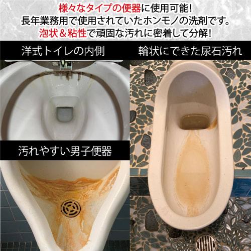 Sanki Professional Toilet Cleaner, Over 150,000 Bottles Sold, Used by Famous Hotels and Major Railway Companies, Restores Shine, Eliminates Stain, and