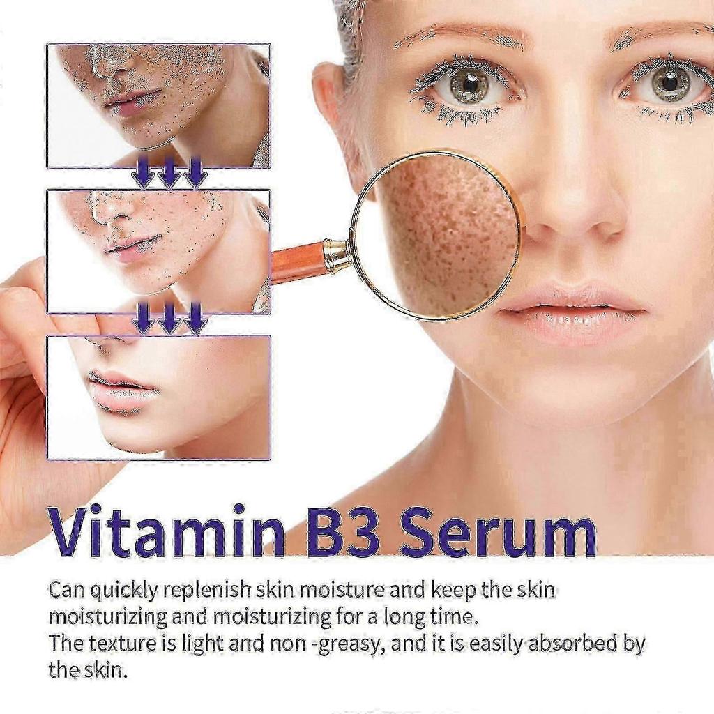 B3 Serum, Dark Spot Corrector B3 Serum With Anti-Aging 10% Niacinamide Discoloration Correcting Serum for Sun Spots, Age Spots & Post-Acne Marks