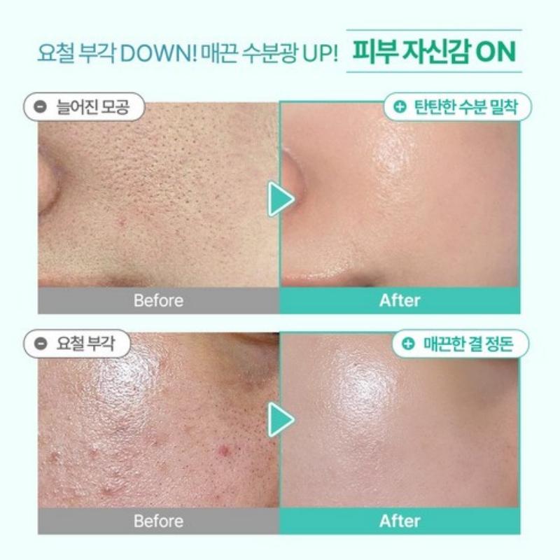 Omitted FreshLime LHA Glow Pore Serum 50ml