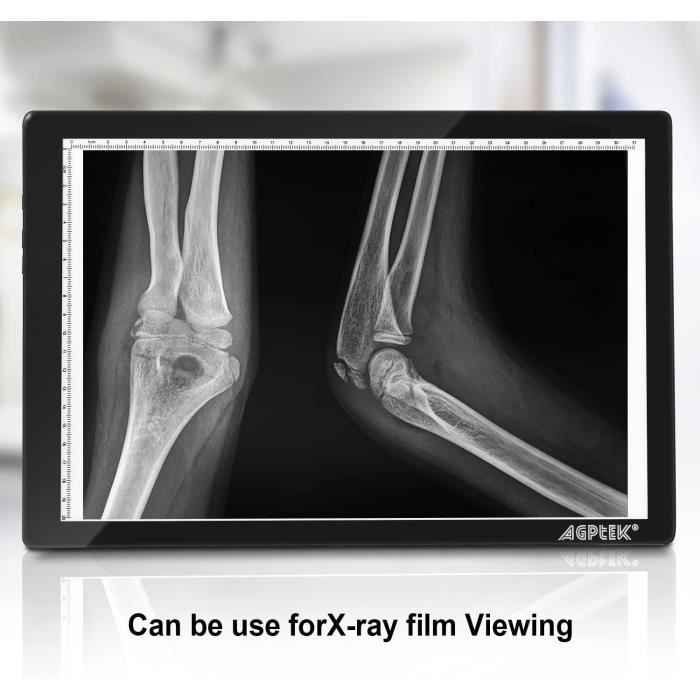 AGPTEK Tablette Lumineuse A4 Avec Luminosité LED Réglable Précise, Fonction Mémoire, l'Adaptateur Secteur Européen Fourni