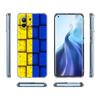 Ukraine Flagge Silikonhülle Für Xiaomi Mi 11 Note 10 10T 9 9T 12 Pro Lite Poco X3 F3 M3 Klare Hülle Redmi 9 9A 9C 10 Hülle Ukraine