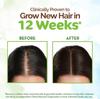 Mamaearth Rosemary Hair Growth Oil For Thicker Stronger Hair | 150ml | Controls Hair Fall | Strengthens Roots | Natural & Safe