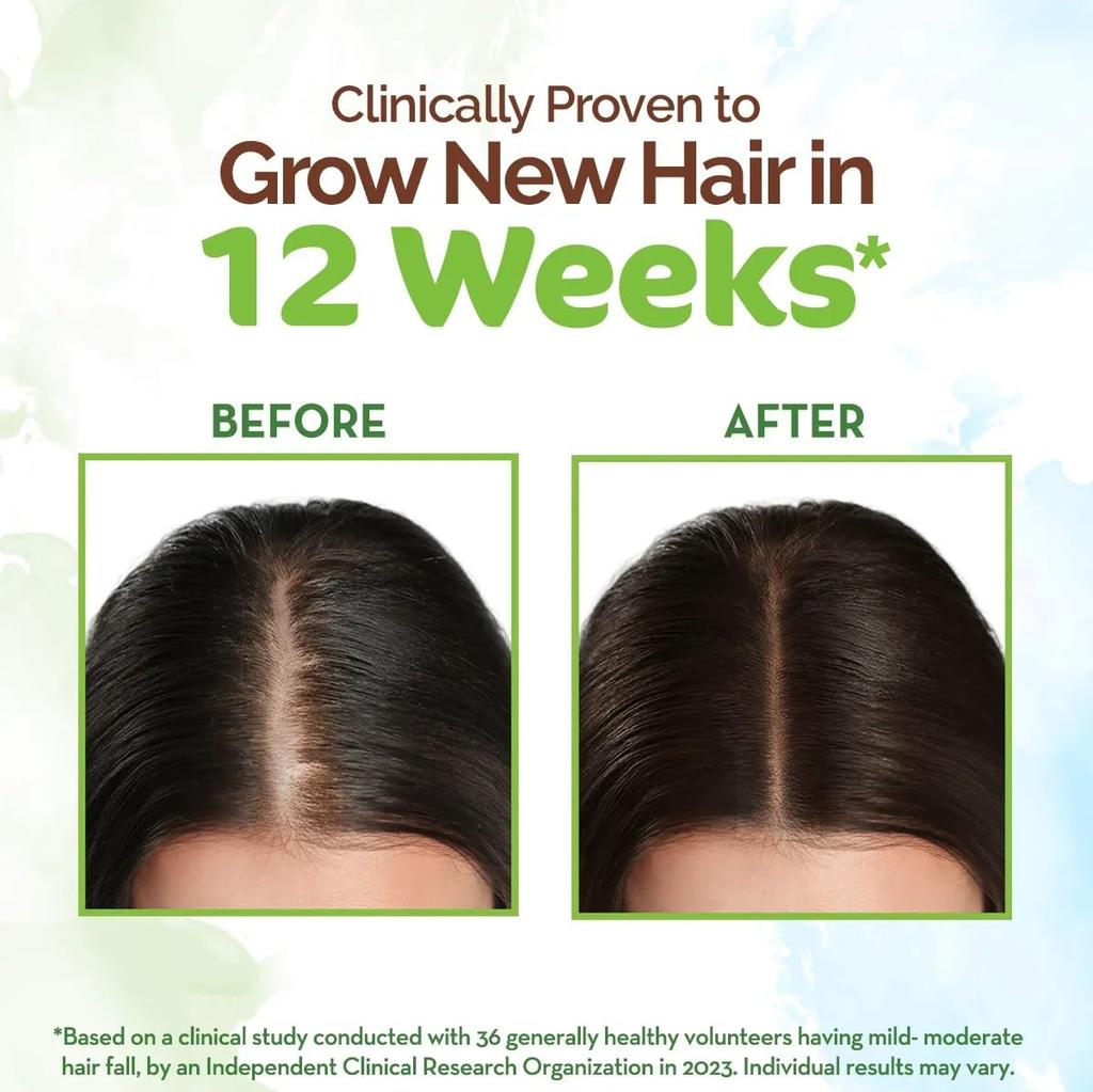 Mamaearth Rosemary Hair Growth Oil For Thicker Stronger Hair | 150ml | Controls Hair Fall | Strengthens Roots | Natural & Safe