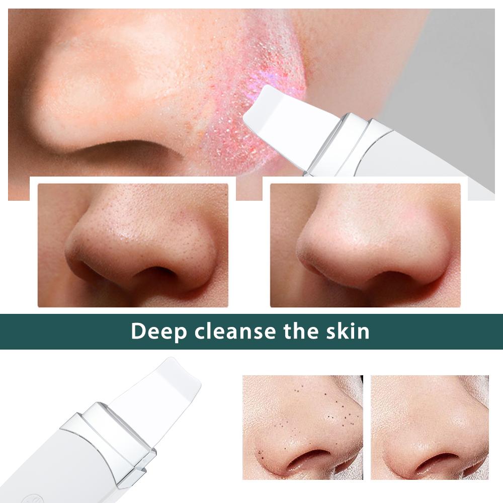 Ultraschall-Hautwäscher, Gesichtsspatel, Mitesser-Entferner, tiefe Gesichtsreinigung, Lift-Maschine, Peeling, Schaufel, Porenreiniger
