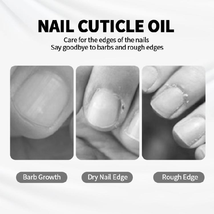Strengthening Cuticle Oil Two Tone Nourishment Fast Absorption For Fragile Splitting Nail