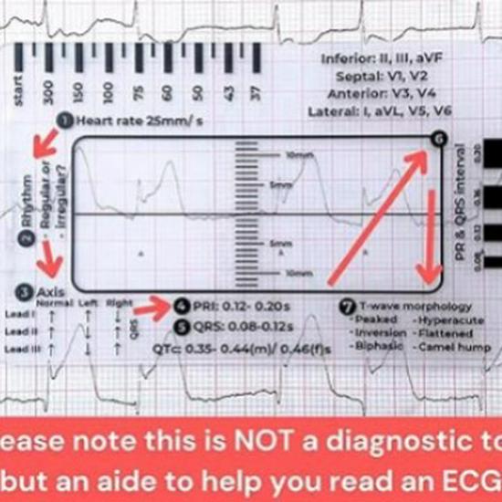 7-Step ECG Interpretation Ruler: Transparent Caliper Tool