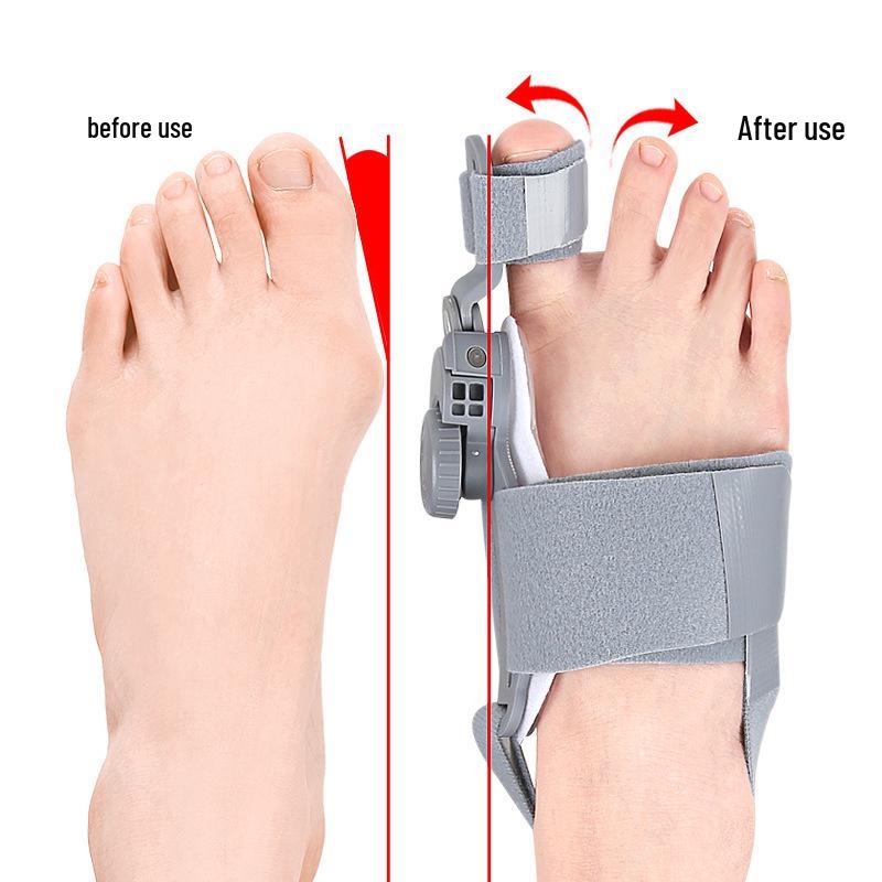 Adjustable Cross-Border Bunion Corrector with Stretch Knob Toe Separator for Day and Night Use