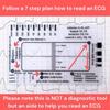 Guida di Riferimento per l'Interpretazione dell'ECG/EKG Righello Trasparente per l'Interpretazione dell'ECG per la Valutazione dell'ECG