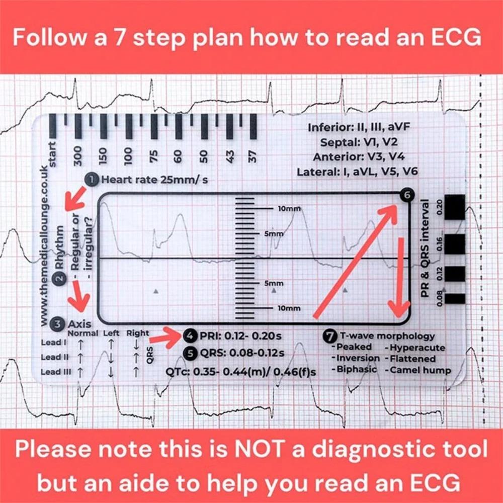 Guida di Riferimento per l'Interpretazione dell'ECG/EKG Righello Trasparente per l'Interpretazione dell'ECG per la Valutazione dell'ECG