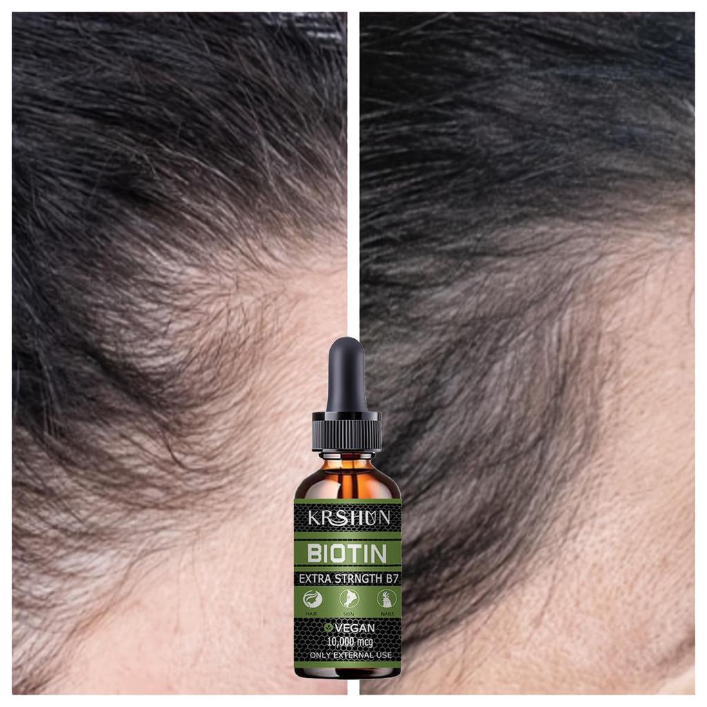 Huile de croissance capillaire entièrement naturelle pour rendre les cheveux plus épais et plus longs et stimuler la croissance des cheveux Produits capillaires Huile de croissance pour femmes noires