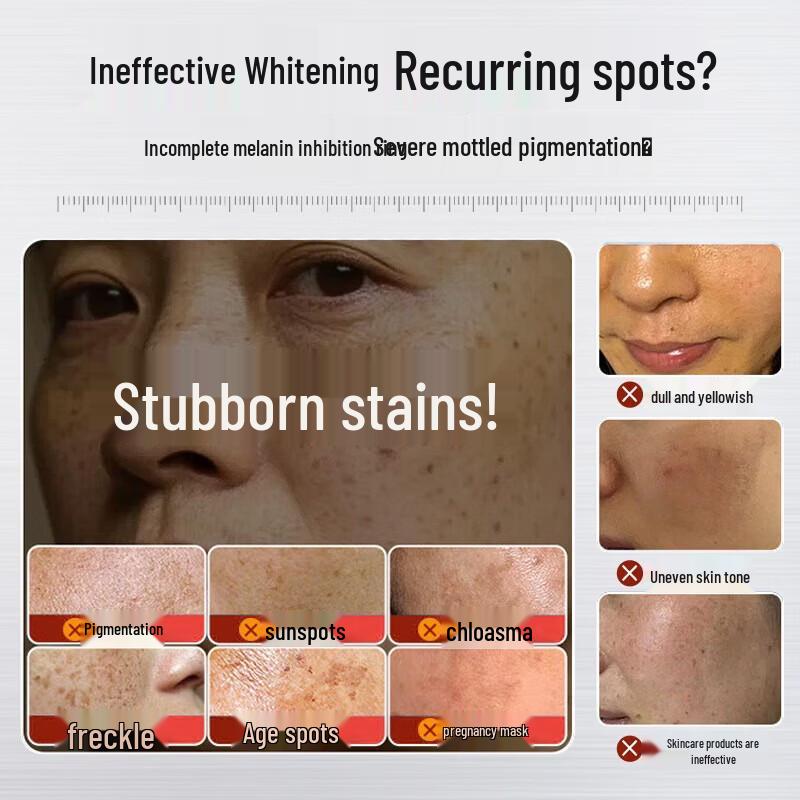 TRUU 377 Whitening & Anti-Spot 5-Piece Skincare Set