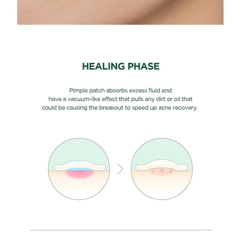 SKIN 1004 - Spot Cover Patch