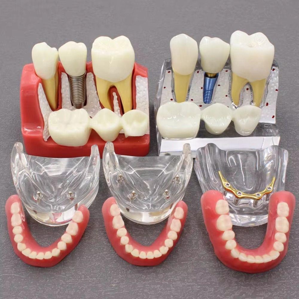 

Transparent Dental Teeth Model Periodontitis Pathological Model Dentistry Teaching Studing Style 5(1:6)
