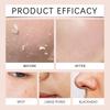 Exfoliating Gel Facial Care Gel Oil-control Moisturizing Refreshing Gel Smmooth Skin,50g